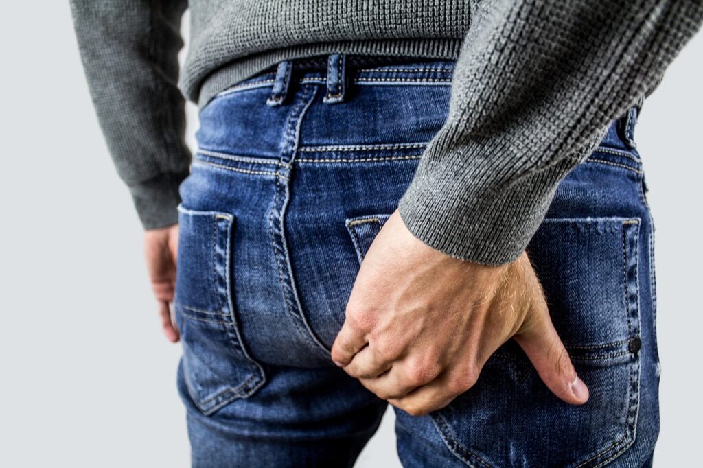 Piles (Hemorrhoids)