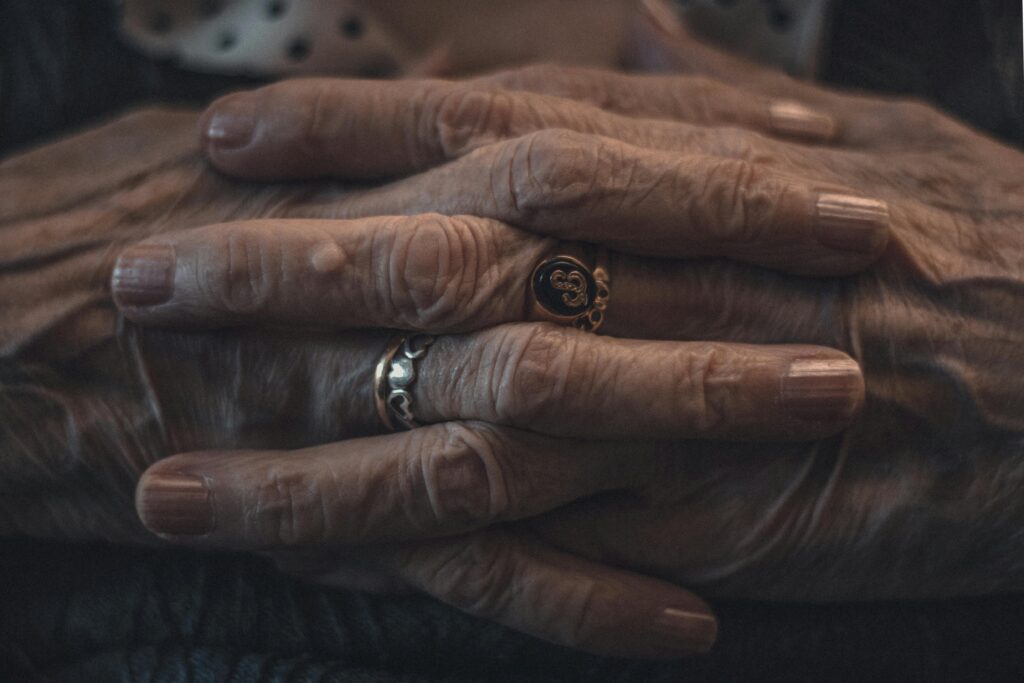 Rheumatoid Arthritis