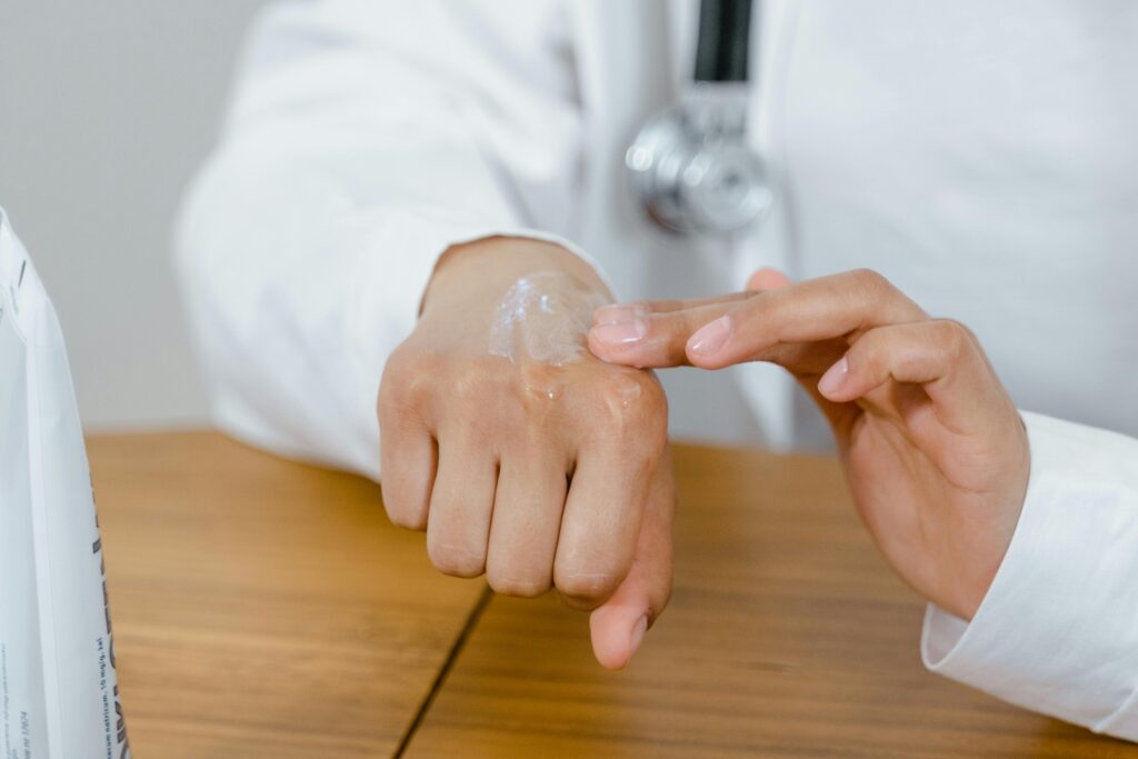 Eczema